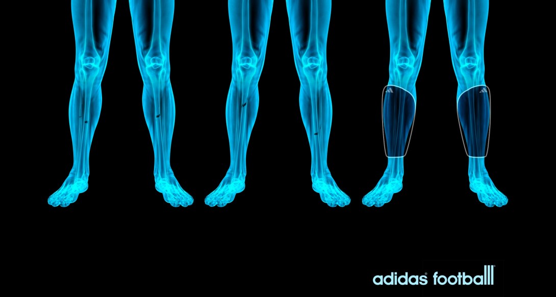 an advertising concept for shin pads - broken bones